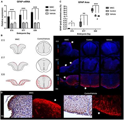 Premature Neural Progenitor Cell Differentiation Into Astrocytes in Retinoic Acid-Induced Spina Bifida Rat Model